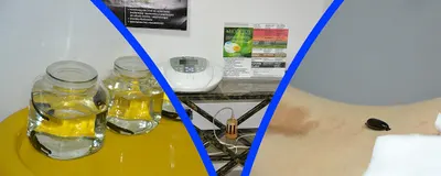 Andrej Lewenczik - kręgarz rehabilitacji